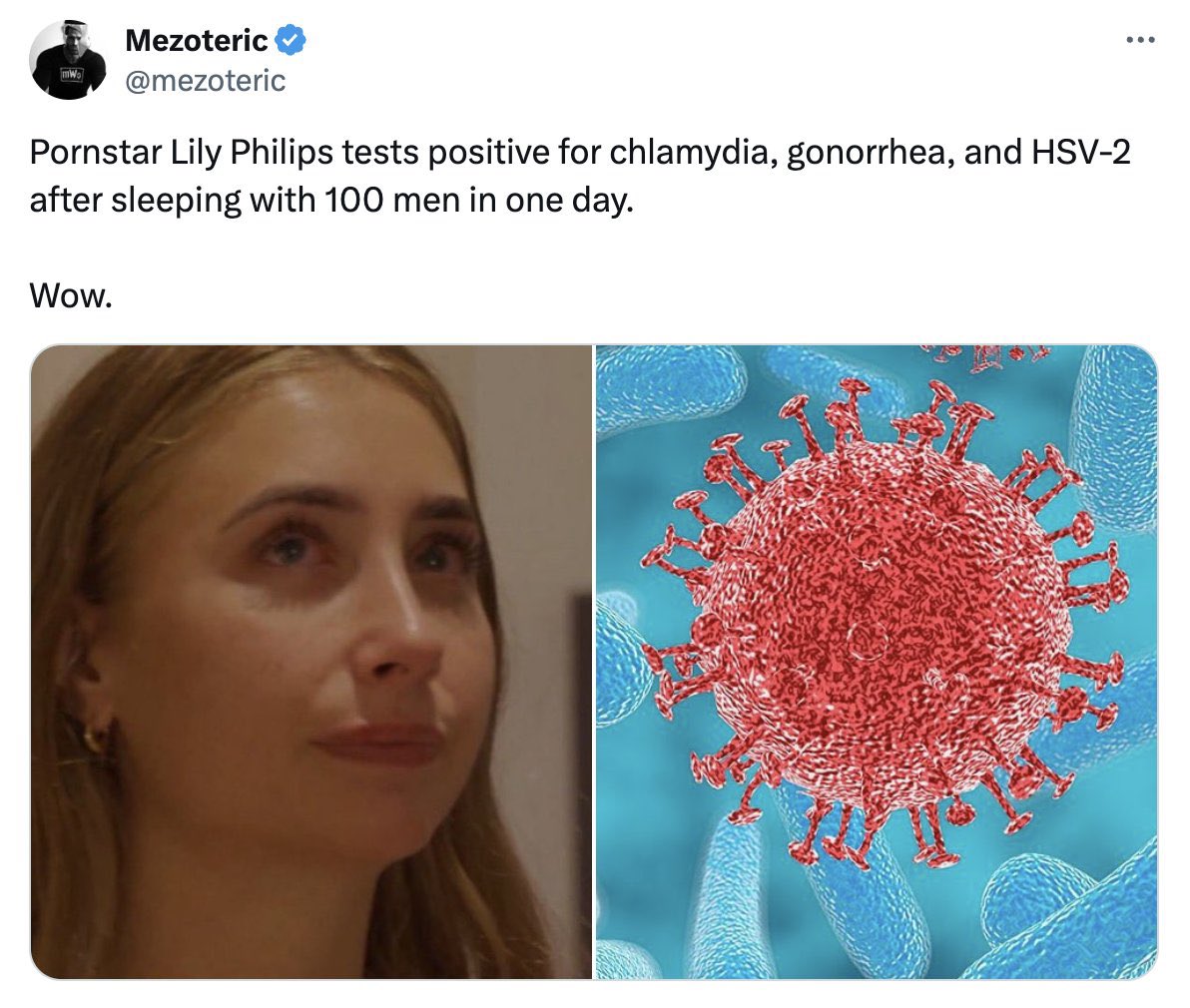 Suzanne Kreiter tweet media