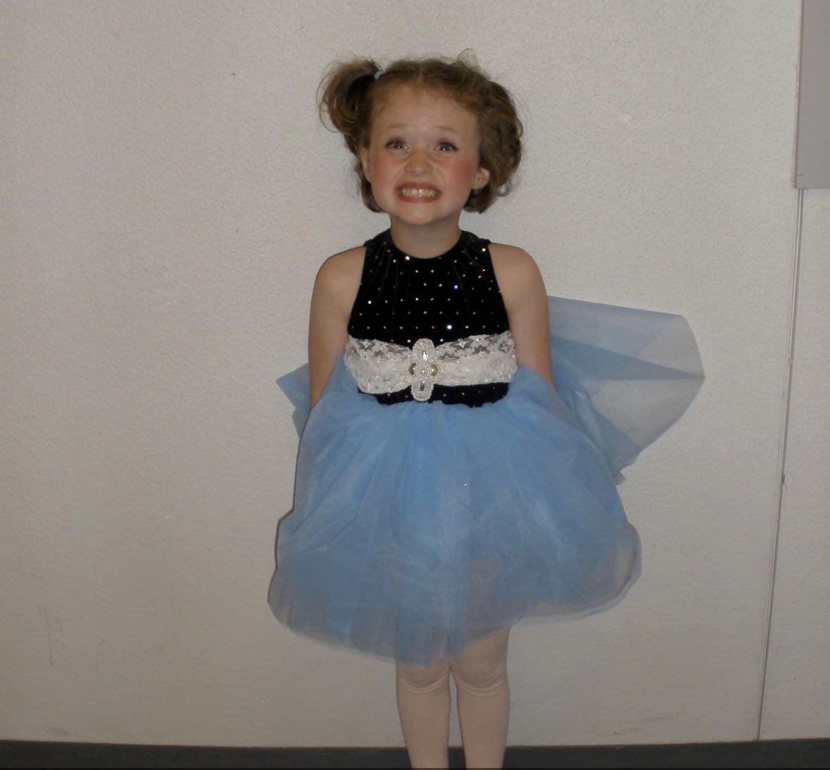 write4chocolate's tweet photo. Her surgery is approved!!!

We are excited but exhausted. 

It shouldn’t take a parent who can write and a kid (young woman) who is willing to share her medical history with the world just to access care. 

And also, HER SURGERY IS APPROVED!! 🩷 

Pics of Natalie over the years. https://t.co/n2Ghilw5OH