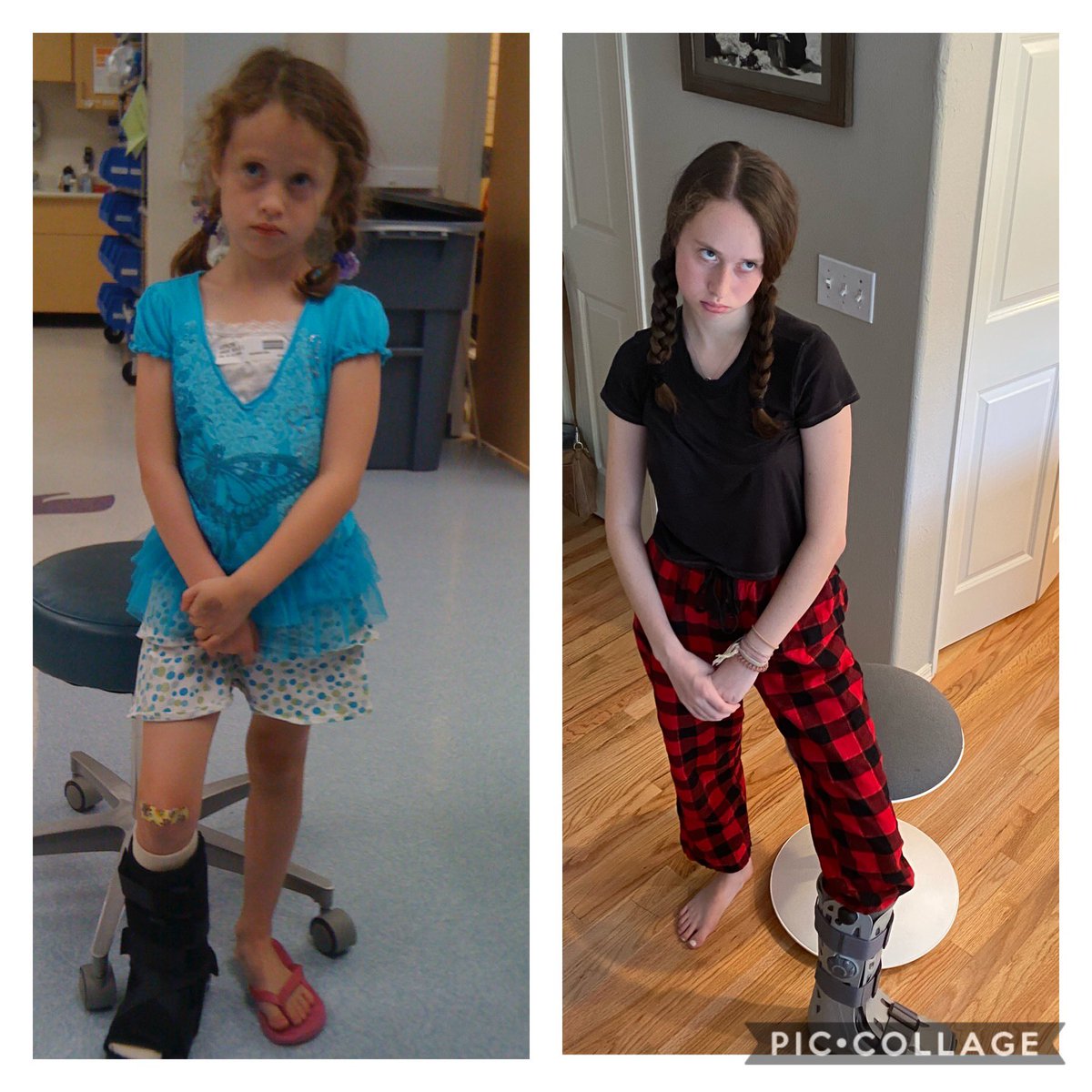write4chocolate's tweet photo. Her surgery is approved!!!

We are excited but exhausted. 

It shouldn’t take a parent who can write and a kid (young woman) who is willing to share her medical history with the world just to access care. 

And also, HER SURGERY IS APPROVED!! 🩷 

Pics of Natalie over the years. https://t.co/n2Ghilw5OH