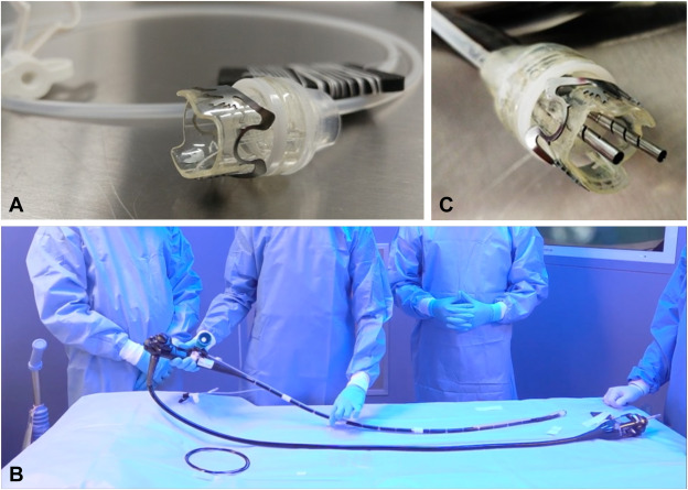 videogie's tweet photo. Kalapala et al share a "Novel approach for weight reduction after Roux-en-Y gastric bypass: combination of Bariatric Anastomotic Reduction System with tubularization of residual gastric pouch." https://t.co/aK3dXOQYN3

@RakeshKalapala1 @SantoshDariset2 @pradev32 @AIGHospitals https://t.co/67oXEdtoVX