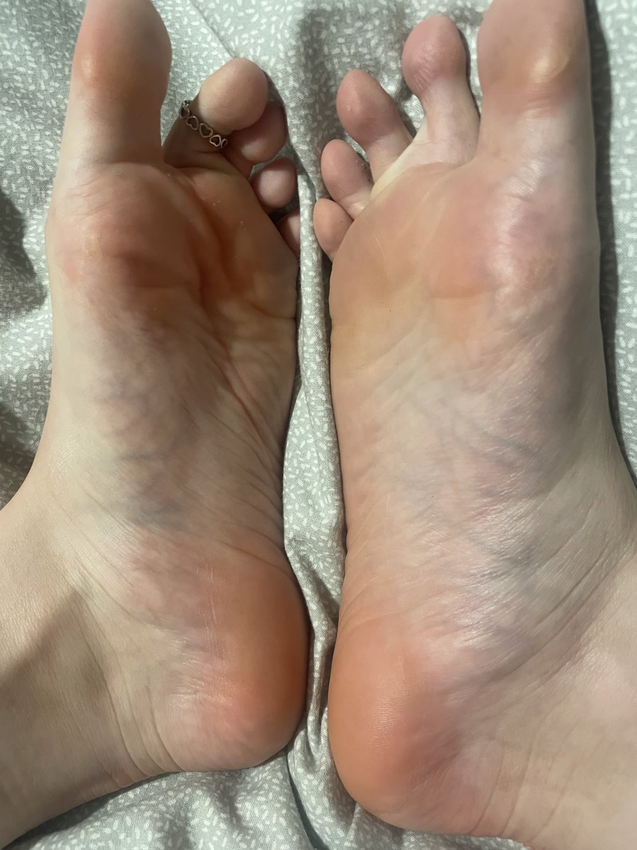 prettyfeetrach's tweet photo. do we prefer wrinkles or no wrinkles? let me know in the comments😉 https://t.co/HNX9cBsF8Z