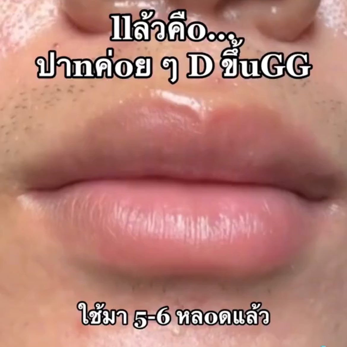 Mcm gituuu je bibir dia heal from gelap to  cerah🥹🫵🏻

I baru pakai few days lemme show you—