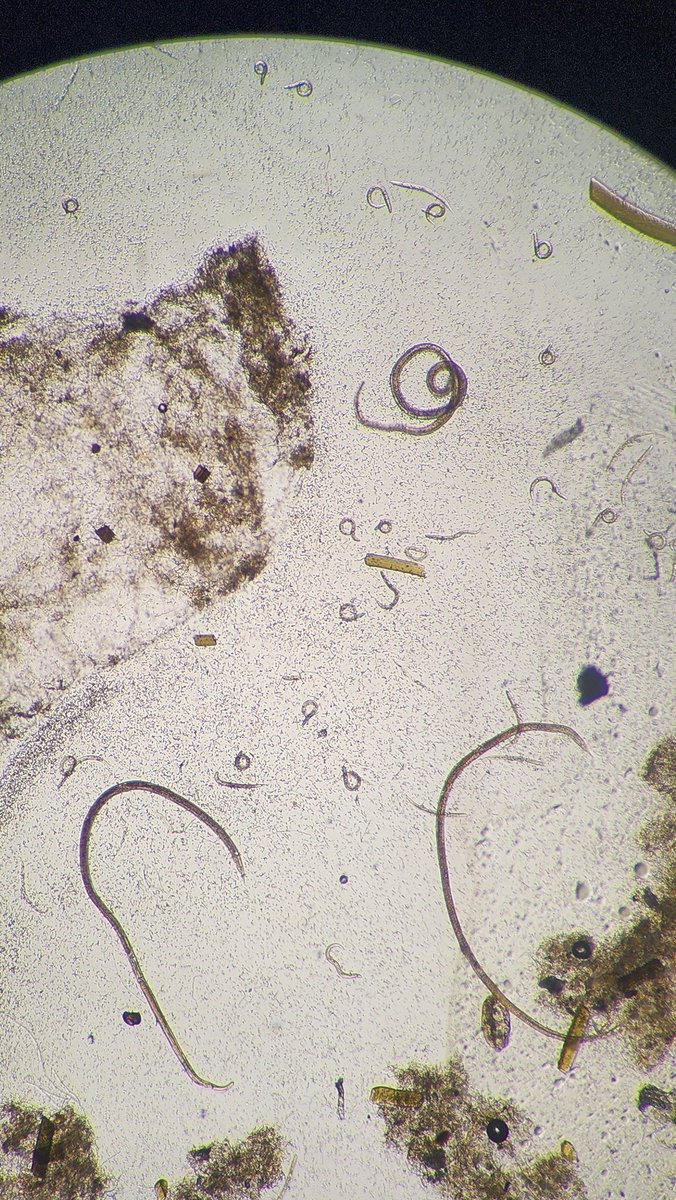 When is Strongy, too much Strongy? Well, anytime...
But especially...when moms look like they are taking their kids out to the park to play!?
Three adult female Strongy and numerous L1 larvae. So much Strongy!
#parasitology
<a href="/ARUPLabs/">ARUP Laboratories</a>