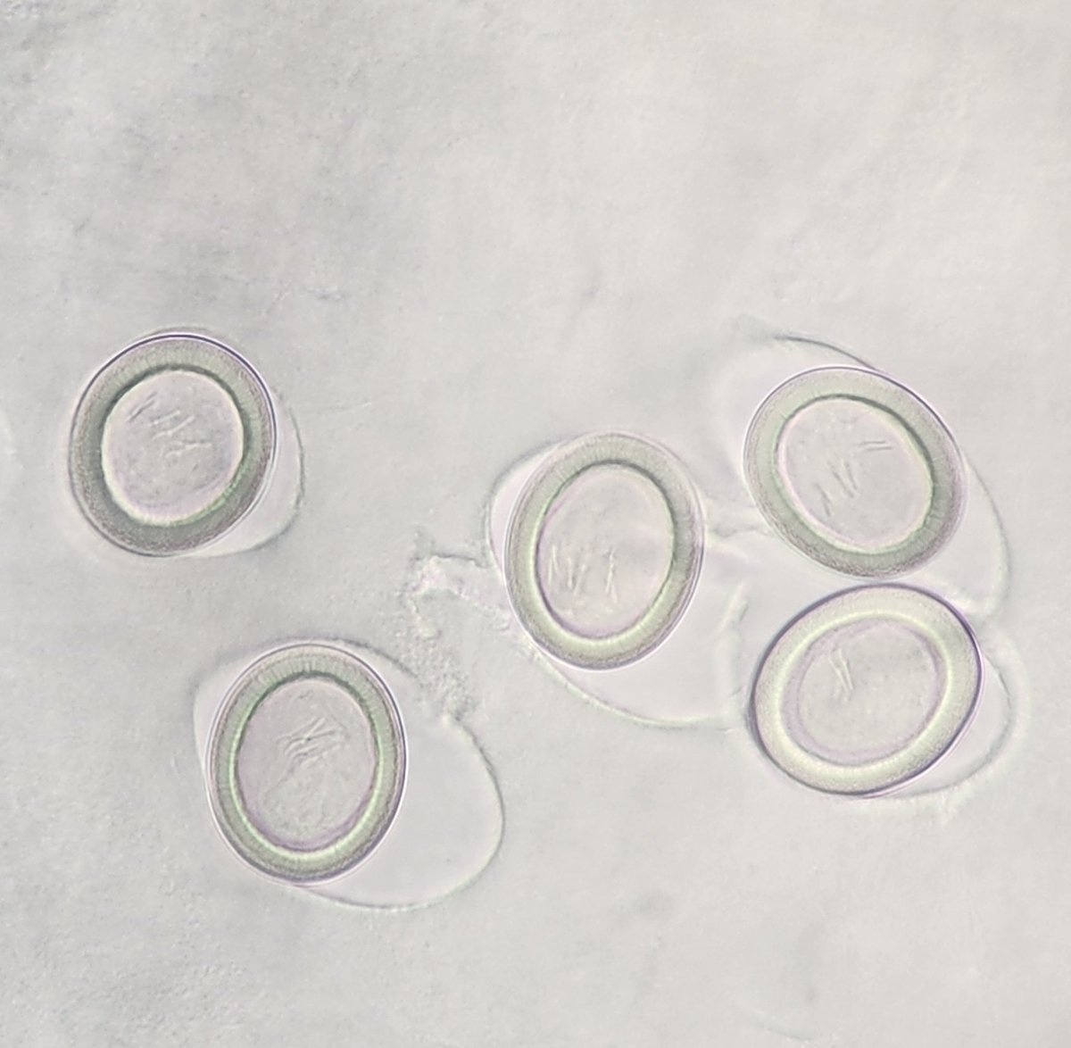 This was a fun. The worm was barely recognizable as a worm. It vaguely looked like a proglottid, but the specimen was badly degraded. Clearing the tissue with some lactophenol exposed the genus-level ID. Taenia eggs in utero. Hooklets visible even!
#Parasitology
<a href="/ParasiteGal/">Bobbi Pritt, MD</a>