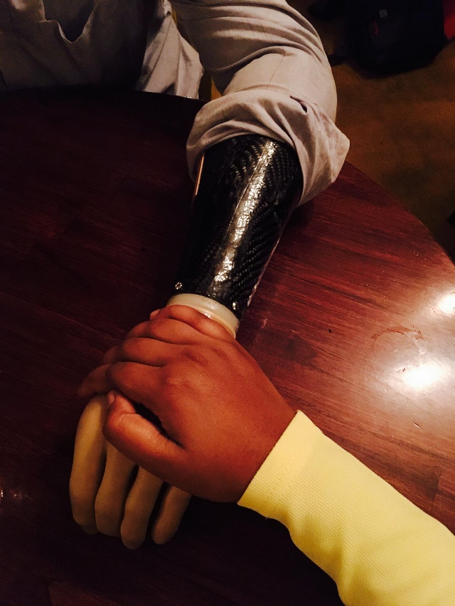 Pure love transcends all ❤️

06 '17, I lost my hand in an accident. 11 '17 I got my artificial hand. She held my hand in her hands. I felt her touch. That day I realised the true power of love. 

🧵