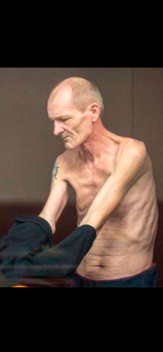 FredFellaIMO's tweet image. History rhymes. 

The first photo is of Holocaust survivors.

The second is of a Ukrainian POW being starved by Russia.

Arm Ukraine!

@realDonaldTrump