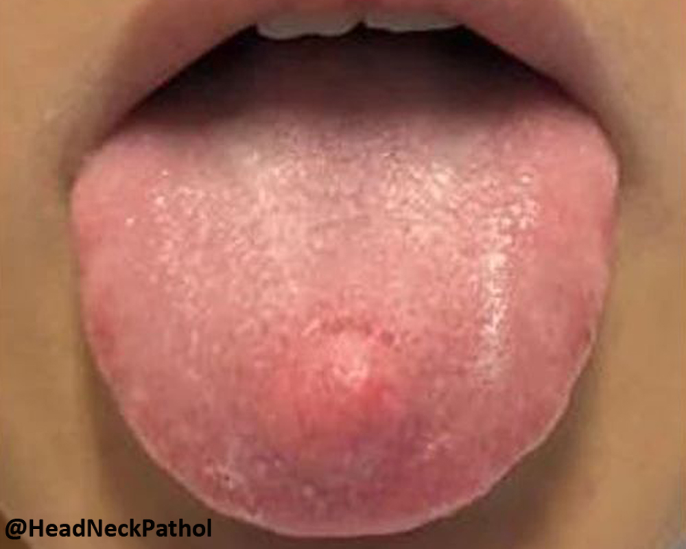 Head Neck Pathol tweet media