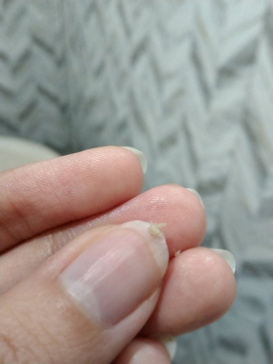 BISA EH HEMPAS KETOMBE PAKE INI😭🙌🏻👏🏻

sebel pol kalo liat ketombe kaya gini tuh, tapi ternyata simple banget pake shampoo ini ketombe udah nggak bandel kaya dulu lagii😚✨

#MellsRoom