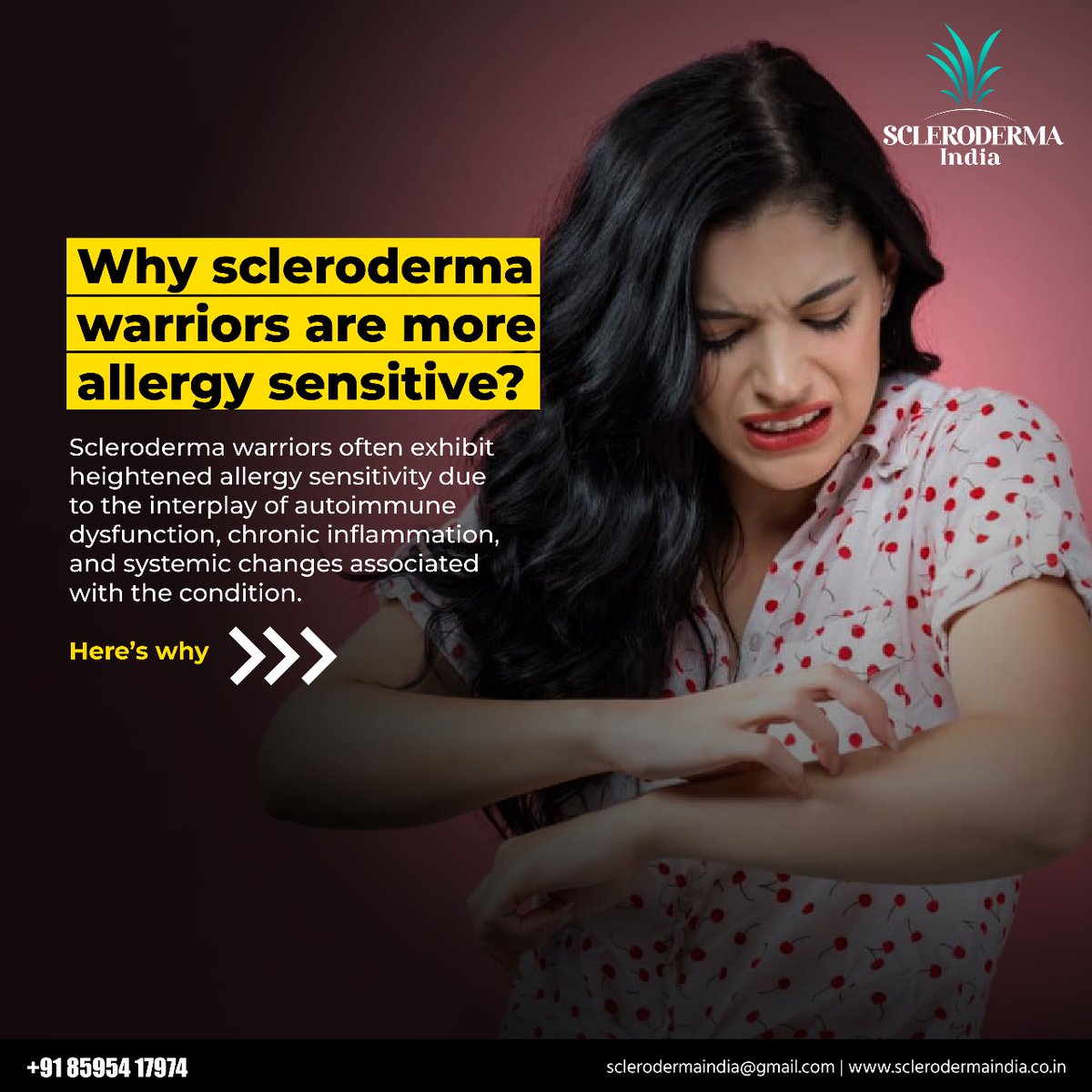 ScleroIndia's tweet image. Scleroderma warriors are more allergy sensitive. Here is why:
#SclerodermaIndia #Scleroderma #chronicillness #AutoImmuneDisease #Allergy #SclerodermaWarriors #Tips