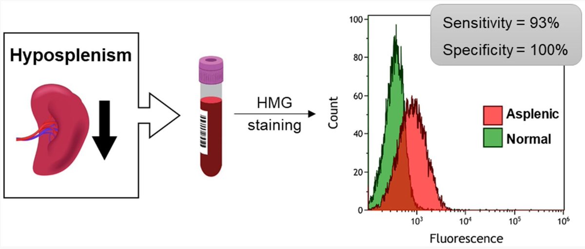 Development of a novel test of splenic function for use in a clinical diagnostic laboratory 
buff.ly/4itfQ2C