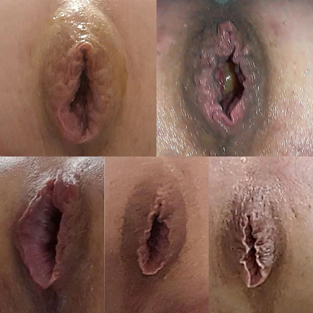 Hormones_pharma's tweet photo. These may not be to everyone’s taste on here but as a bottom fetishist I think they’re absolutely mesmerising and an inspiration to any wannabe sissy or sub bottom! 😈😍😈 https://t.co/KZLry5pEDl