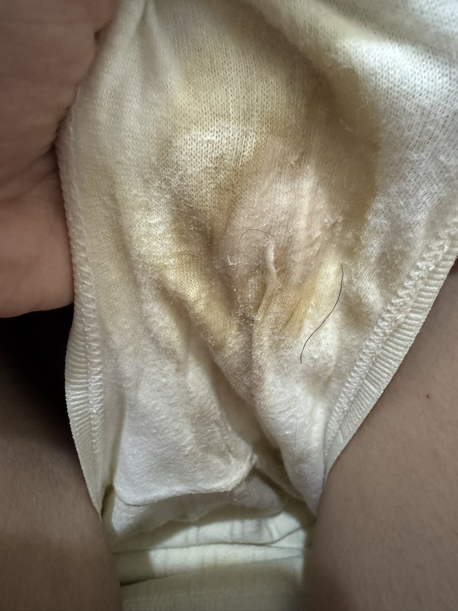 媒体预览