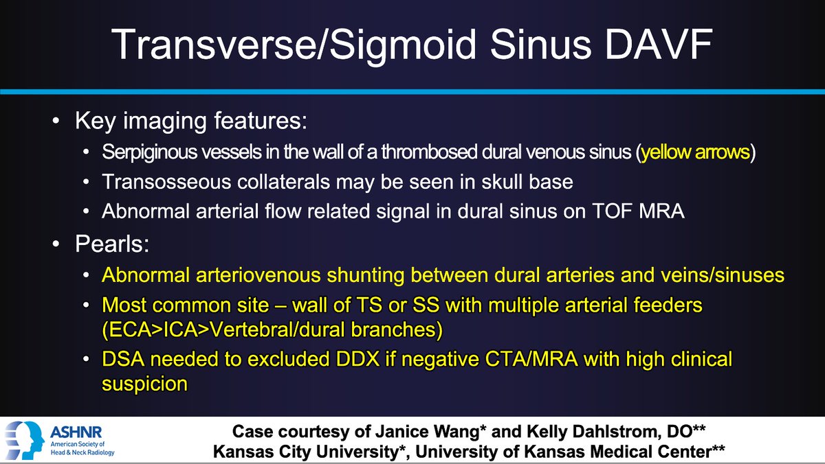 ASHNR (@ashnrsociety) on Twitter photo #ASHNRCOTW #278: ANSWER. Thx <a href="/janice_a_wang/">janicewang</a> +
<a href="/kelly_dahlstrom/">Kelly Dahlstrom</a> 4 case! #ASHNR25
<a href="/callyrobs/">Caroline Robson, MBChB</a> <a href="/DShatzkes/">Deborah Shatzkes</a> <a href="/CDP_Rad/">C Douglas Phillips 🇺🇸</a> <a href="/rhwiggins/">Richard Wiggins</a>
<a href="/nakoontz/">Nicholas Koontz</a> <a href="/KRileyMD/">Kalen Riley</a> <a href="/CMGlastonbury/">Christine M Glastonbury, MD</a> <a href="/tabby_kennedy/">Tabby A. Kennedy, MD</a> <a href="/PhilipRChapman1/">Philip R. Chapman, MD</a> <a href="/MohitTCCNeuro/">Mohit Agarwal</a> <a href="/AshokSrini15/">Ashok Srinivasan</a> <a href="/amyfjuliano/">Amy Juliano</a> <a href="/CynXinWu/">Cynthia Xin Wu</a> <a href="/bpoliceni/">Bruno Policeni</a> <a href="/KatieTraylorDO/">Katie S. Traylor MS, DO, DABR</a> #ASHNRCOTW #278: ANSWER. Thx <a href="/janice_a_wang/">janicewang</a> +
<a href="/kelly_dahlstrom/">Kelly Dahlstrom</a> 4 case! #ASHNR25
<a href="/callyrobs/">Caroline Robson, MBChB</a> <a href="/DShatzkes/">Deborah Shatzkes</a> <a href="/CDP_Rad/">C Douglas Phillips 🇺🇸</a> <a href="/rhwiggins/">Richard Wiggins</a>
<a href="/nakoontz/">Nicholas Koontz</a> <a href="/KRileyMD/">Kalen Riley</a> <a href="/CMGlastonbury/">Christine M Glastonbury, MD</a> <a href="/tabby_kennedy/">Tabby A. Kennedy, MD</a> <a href="/PhilipRChapman1/">Philip R. Chapman, MD</a> <a href="/MohitTCCNeuro/">Mohit Agarwal</a> <a href="/AshokSrini15/">Ashok Srinivasan</a> <a href="/amyfjuliano/">Amy Juliano</a> <a href="/CynXinWu/">Cynthia Xin Wu</a> <a href="/bpoliceni/">Bruno Policeni</a> <a href="/KatieTraylorDO/">Katie S. Traylor MS, DO, DABR</a>