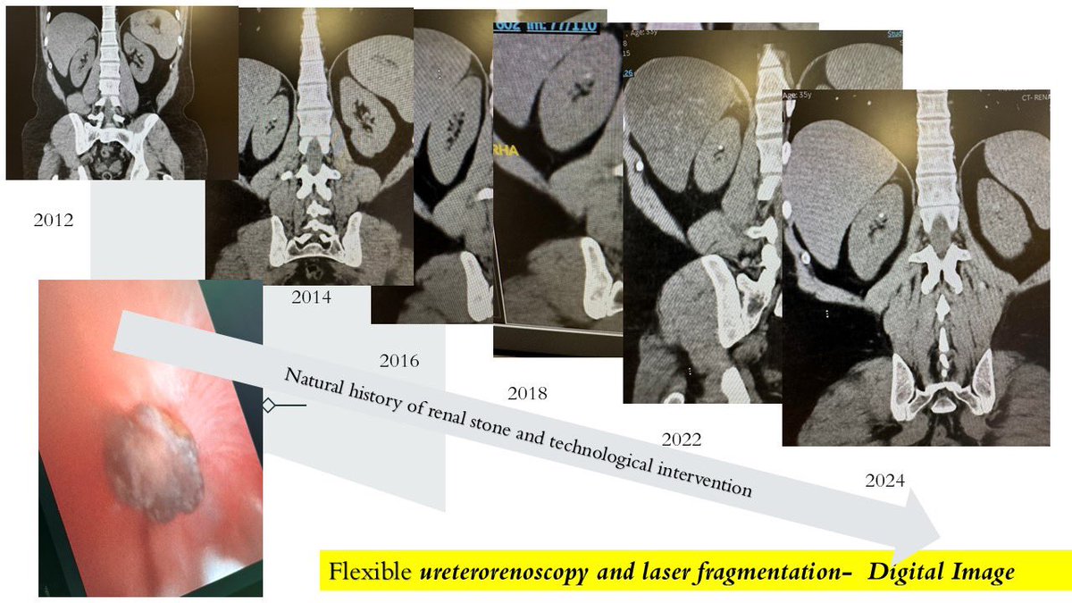 Digital imaging and miniaturised technology impacting natural history of disease