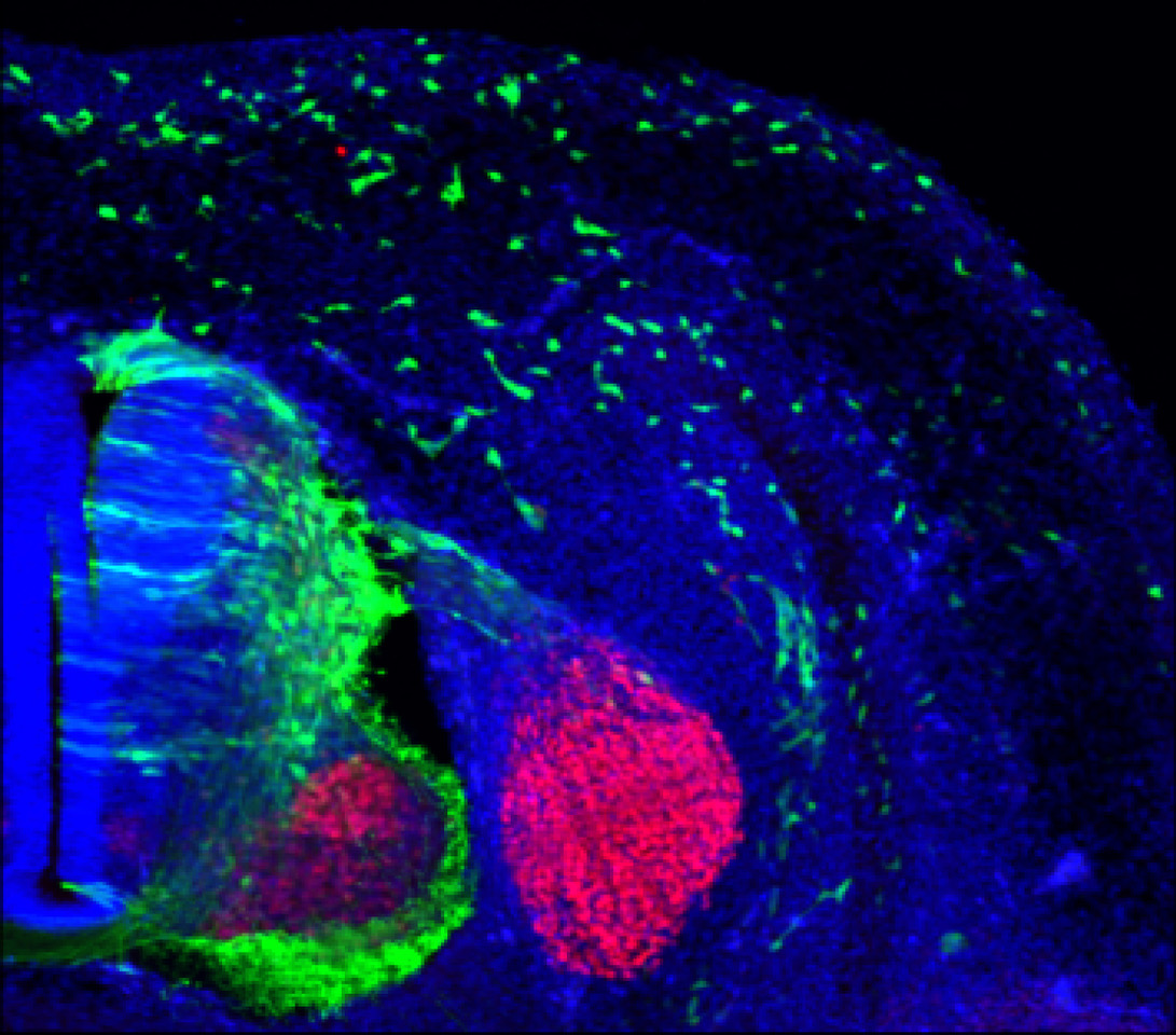 CSIC (@csic) on Twitter photo 🦠Revelan un puente clave en la comunicación genética del desarrollo craneofacial
🔬Un estudio coliderado por el <a href="/NeuroAlc/">Instituto de Neurociencias UMH-CSIC</a> descubre los genes que controlan la migración celular de la que depende el desarrollo de la estructura facial
➡️tiny.cc/huw0001 🦠Revelan un puente clave en la comunicación genética del desarrollo craneofacial
🔬Un estudio coliderado por el <a href="/NeuroAlc/">Instituto de Neurociencias UMH-CSIC</a> descubre los genes que controlan la migración celular de la que depende el desarrollo de la estructura facial
➡️tiny.cc/huw0001