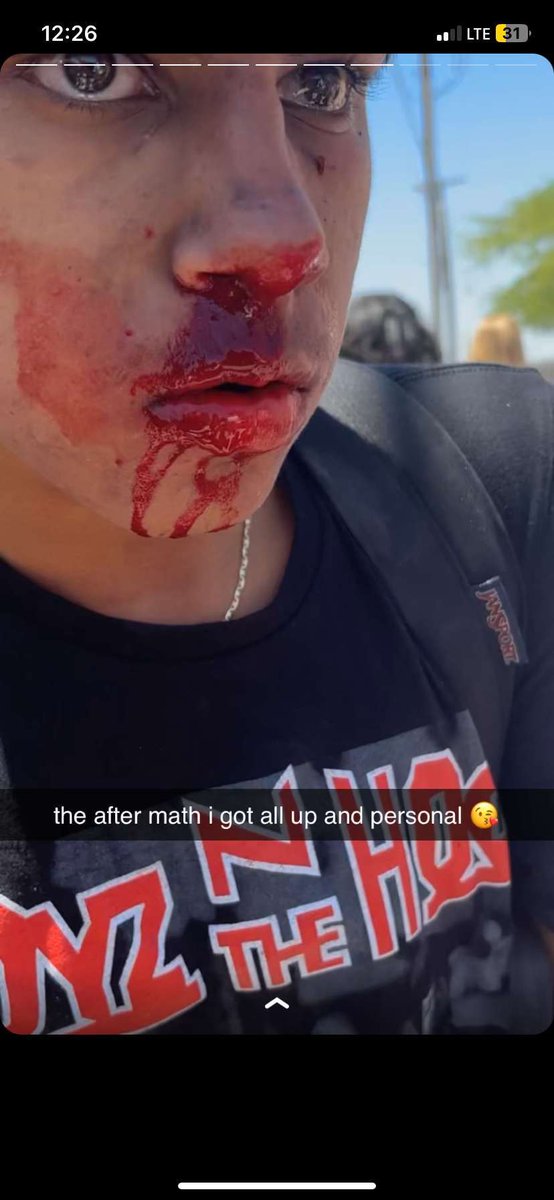 n1njafights's tweet photo. Got caught taking to the other guys' homeboy's girl, got his ass beat in three different angles 😂 https://t.co/mrfxRfJEvd