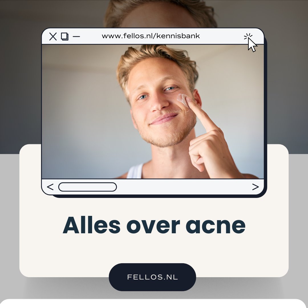 Hoewel niet gevaarlijk kan acne wel cosmetisch storend zijn en daardoor een behoorlijke impact hebben. Gelukkig bestaan er verschillende effectieve en bewezen behandelingen. Lees meer over de oorzaken, behandelingen en preventie tips in het blog van Drs. Westenberg.