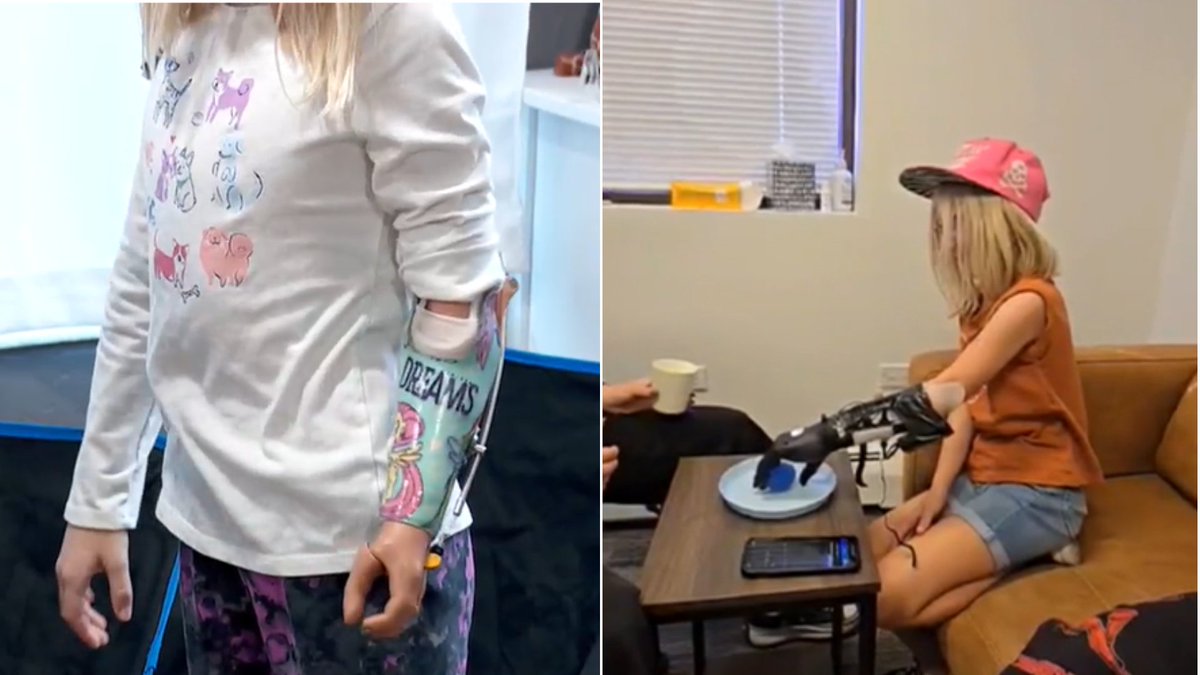 ‼'NOT MEDICALLY NECESSARY'😱: A family says their insurance denied paying for a prosthetic arm for their 9-year-old child. INFO:  kwtx.com/2024/12/12/not…