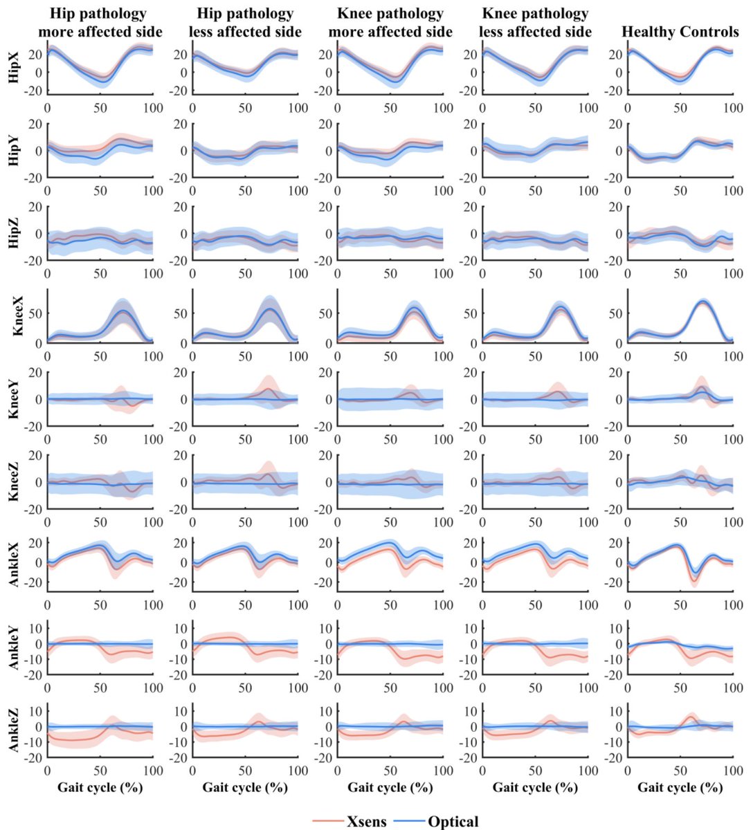 JBiomech's tweet photo. 😃New article published in J Biomech!

"Validity of an inertial measurement system to measure lower-limb kinematics in patients with hip and knee pathology", by Wang et al.

��� https://t.co/pOrjfZshrN

#journalofbiomechanics https://t.co/uRClpFj6dJ