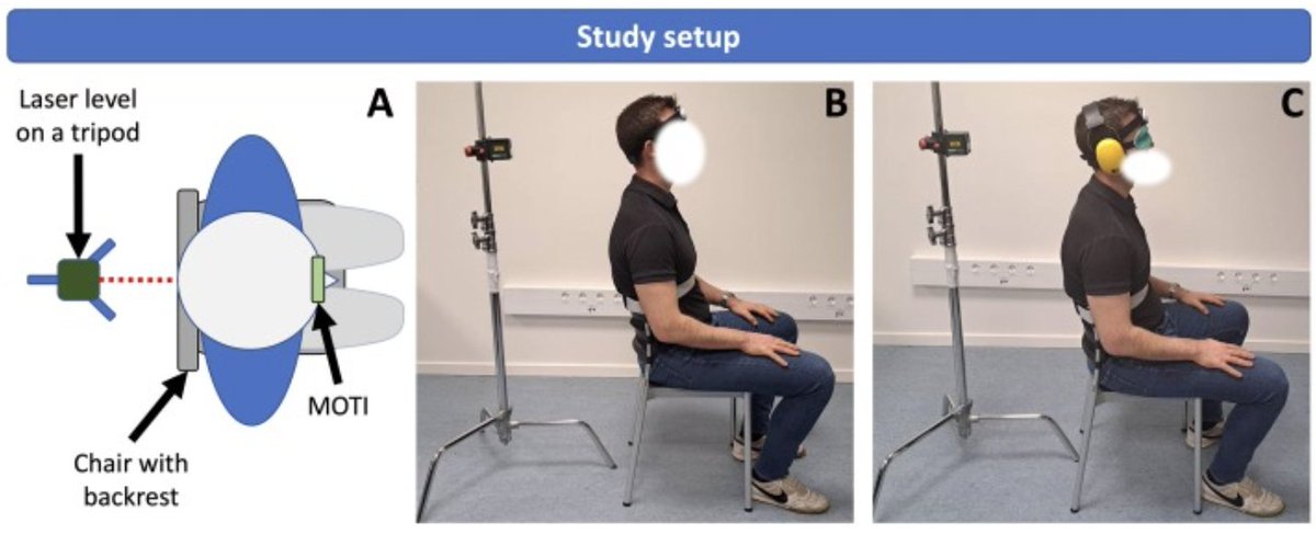 😃New article published in J Biomech!

"Quantifying Cervical Rotation Smoothness: Exploring Various Jerk Metrics and Test-Retest Reliability of Jerk, range of Motion, and Head Repositioning Accuracy", by Parikh et al.

👀 sciencedirect.com/science/articl…

#journalofbiomechanics