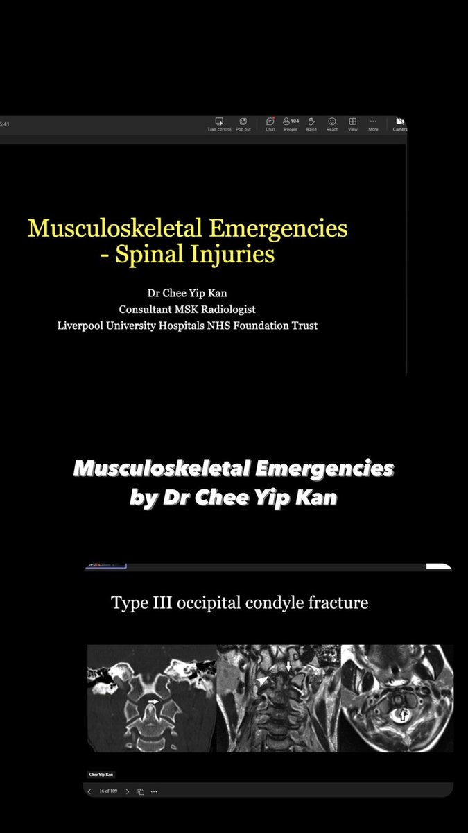 Brilliant talk by Dr Chee Yip Kan on MSK emergencies! #BSER2024 <a href="/BSSR_Site/">BSSR</a>