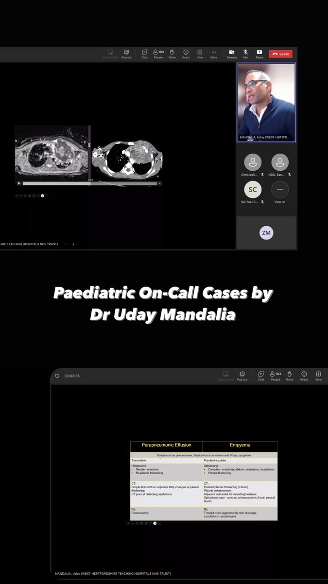 BSER (@bseradiology) on Twitter photo An excellent talk on Paediatric On-Call Cases by Dr Uday Mandalia! #BSER2024 <a href="/WestHertsNHS/">West Herts Teaching Hospitals NHS Trust</a> An excellent talk on Paediatric On-Call Cases by Dr Uday Mandalia! #BSER2024 <a href="/WestHertsNHS/">West Herts Teaching Hospitals NHS Trust</a>
