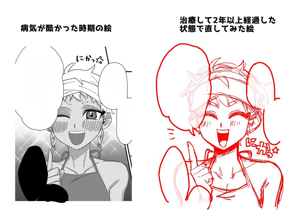 描いた絵がおかしい時は病気を疑った方が良い例です。 