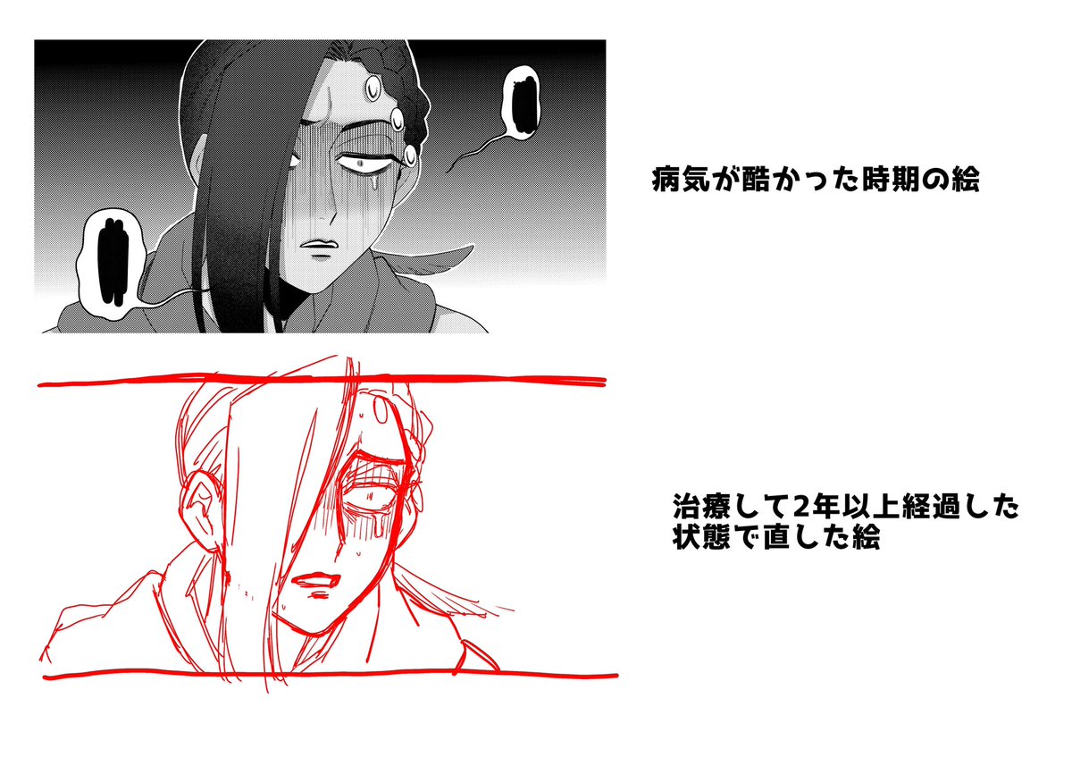 描いた絵がおかしい時は病気を疑った方が良い例です。 
