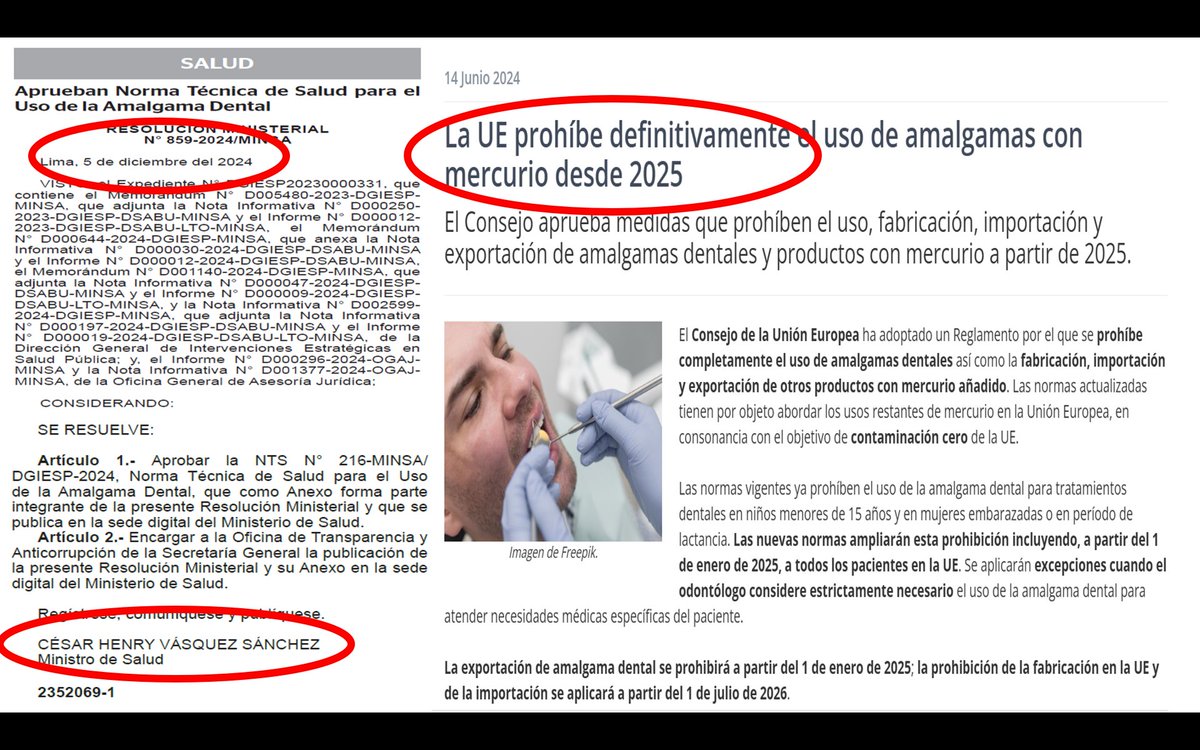 Terrible lo que sucede con la salud de los Peruanos, mientras el mundo ya prohíbe completamente uso de la amalgama por el mercurio que es altamente nocivo para la salud, MINSA saca estos dias una norma técnica para uso de amalgama, una locura ya para 2021 no se usaba, que raro...