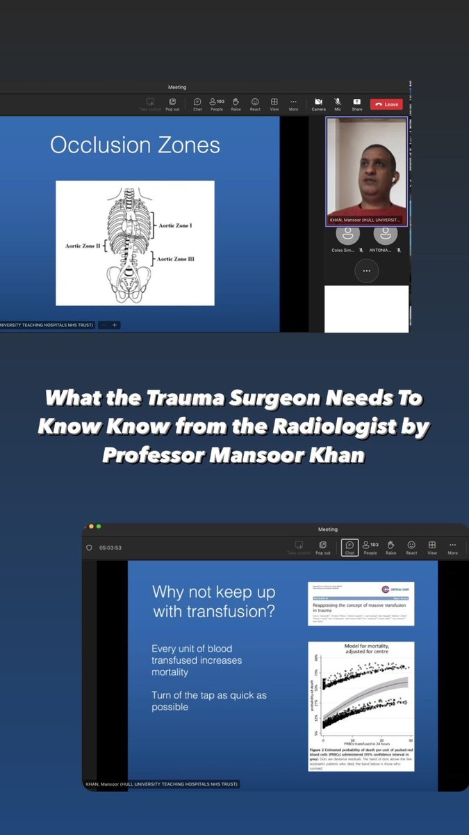A really interesting and insightful talk on What the Trauma Surgeon Needs To Know Know from the Radiologist by Professor Mansoor Khan! #BSER2024