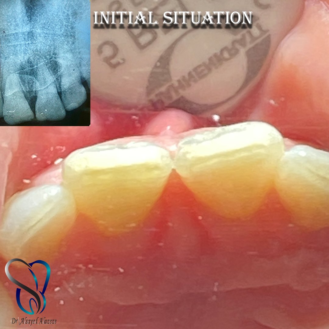 Alsayed Alazeze tweet media