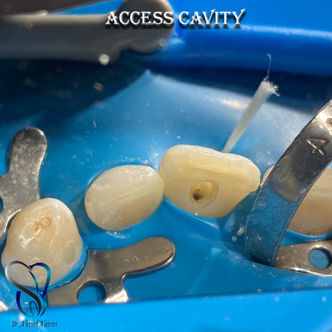 Alsayed Alazeze tweet media