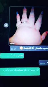 #بس_حبيت_اقول

صحيح مثلاً الكاميرا تطلع يدي دبا وهي بالواقع عود  اسنان 👀 ليش يفهموني غلط😂😂😂