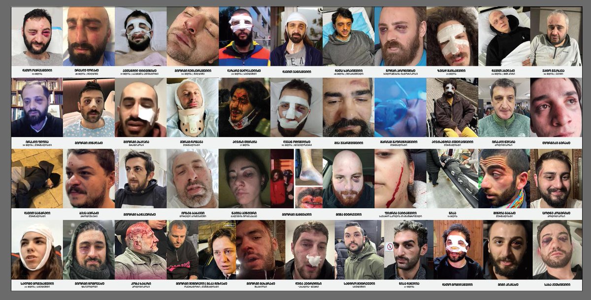 ServingG32005's tweet photo. Over 460 detained, 300+ tortured/abused, 80+ hospitalized, and 90+ journalists injured. 10 foreigners also detained. Yet, no police held accountable.
Freedom to political prisoners!✊
#Georgiaprotests #TbilisiProtests #ServingGeorgia https://t.co/CIuSvRerYB