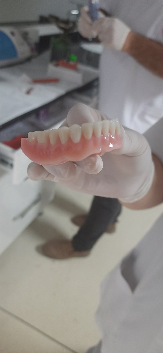 #EmeğimeDokunma  Sağlıkta sopalı, havuçlu mevcut performans sistemi=Para-sağlık ilişkisi=Halk sağlığının bozulması=Hasta insan sayısının artması=Sağlık harcamasının artması=Randevu bulamama=Yenidoğan çeteleri=İhaleci firmalar=10 dakikada diş muayenesi=Sağlıkta daha fazla