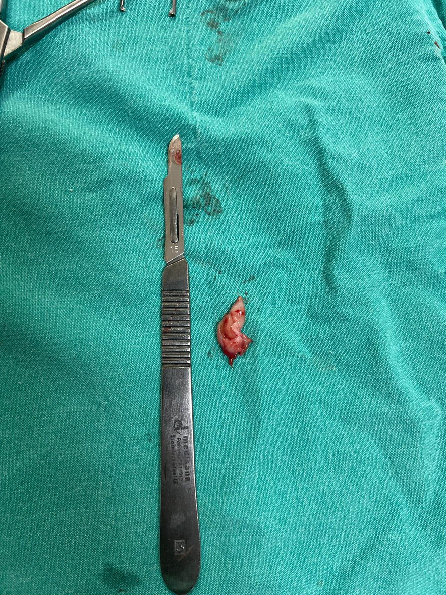 #EmeğimeDokunma
Emeğimi geri ver...
<a href="/saglikbakanligi/">T.C. Sağlık Bakanlığı</a> <a href="/drmemisoglu/">Prof. Dr. Kemal Memişoğlu</a> <a href="/sbkhgm/">Kamu Hastaneleri Genel Müdürlüğü</a>