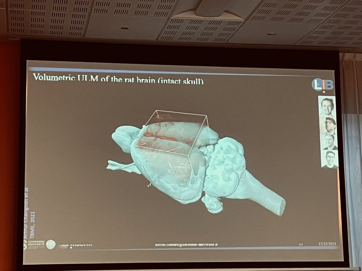 Brain vascular imaging in live animal… 3D-ULM rocks ! 
Great talk by Olivier Couture at the « folle journée de l’anévrisme »