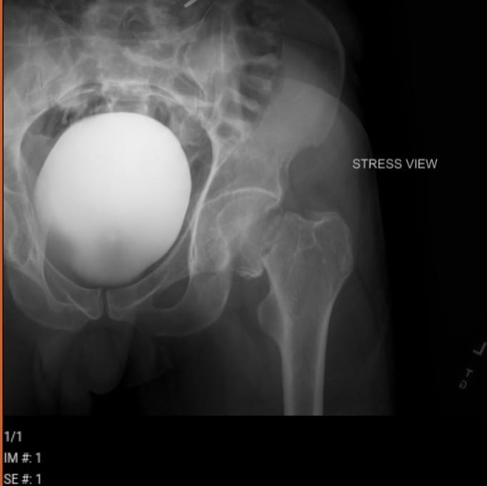 Here's another picture of when the A.i. attacked me.