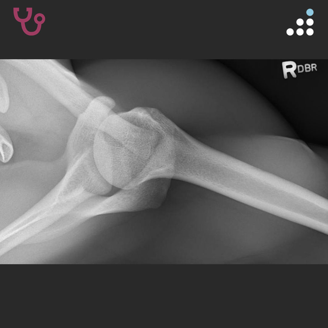 Orthobullets tweet media