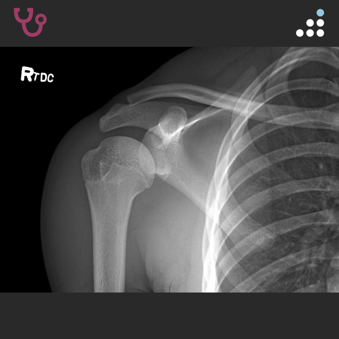 Orthobullets tweet media