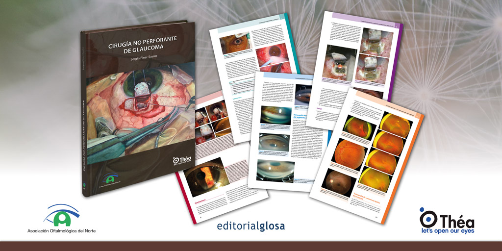 Estamos encantados de presentar el libro "Cirugía no perforante de glaucoma", una obra imprescindible para oftalmólogos y especialistas en glaucoma.

Gracias al Dr. Sergio Pinar-Sueiro, coordinador de la obra, a los autores y a la AON además del patrocinador Laboratorios Théa.