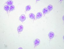 Patient with abdominal pain and diarrhea.

Diagnosis??
