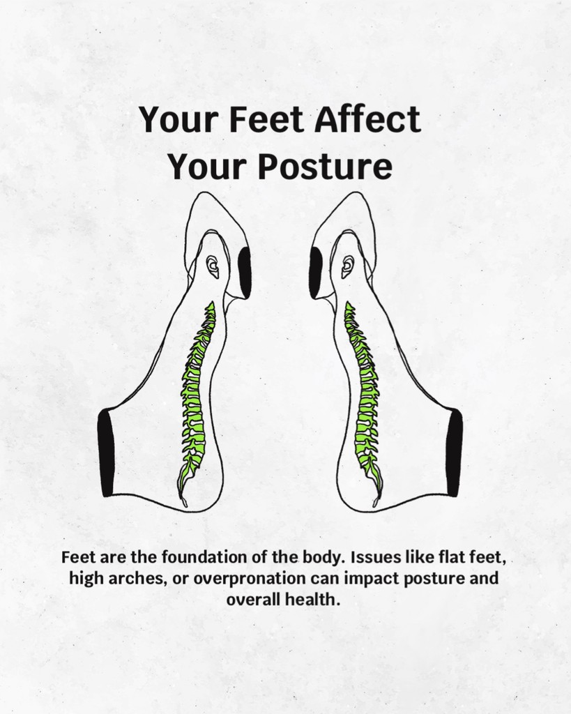 Feet are the foundation of your body. Issues like flat feet, high arches, or overpronation can ripple through your posture, impacting your overall health. Take care of your foundation easily with AVOS!