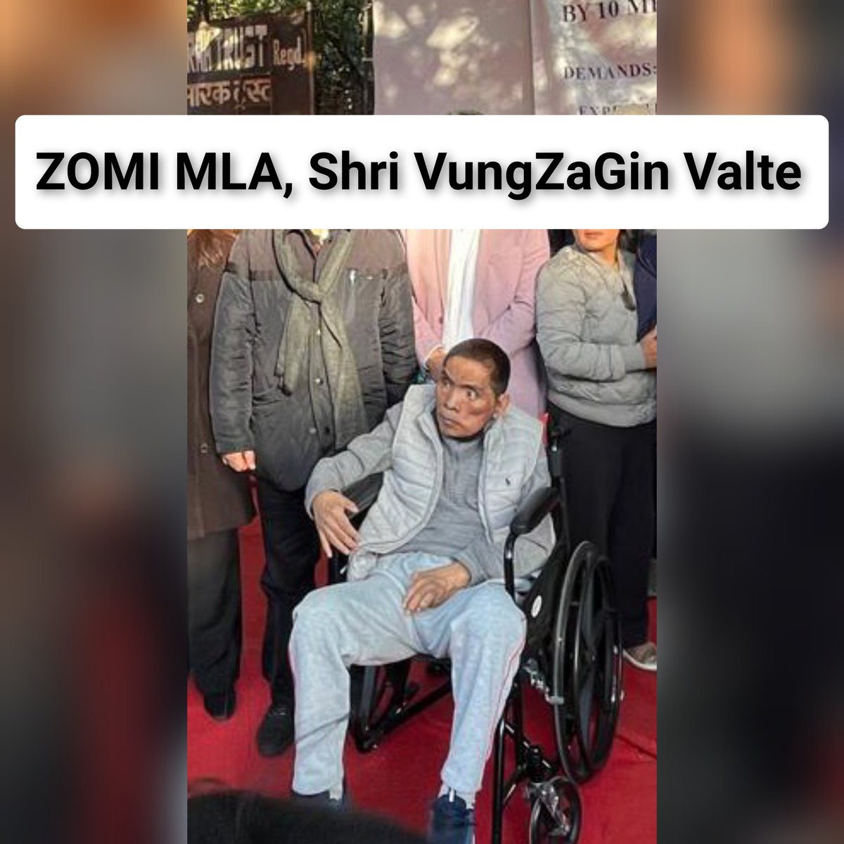biak777's tweet photo. Zomi MLA VungZaGin,brutally attacked by Meitei militants last year, which left him crippled and with a deformed face, despite the severe injuries,he continued his fight against the oppressive Meitei government &amp; took part in the sit-in protest in Delhi.
@TribalArmy @Kap57608111 https://t.co/ccS59JXqNC