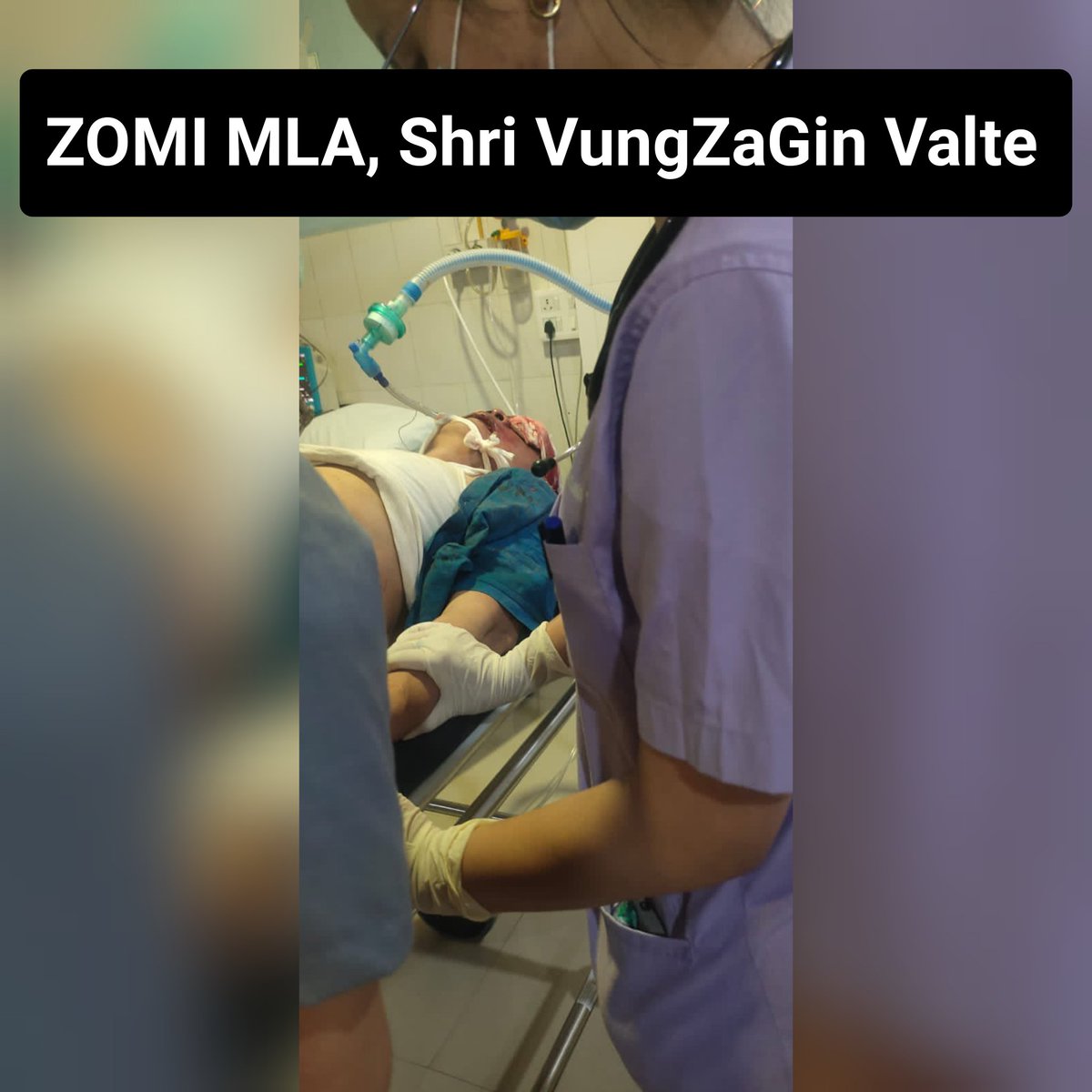 biak777's tweet photo. Zomi MLA VungZaGin,brutally attacked by Meitei militants last year, which left him crippled and with a deformed face, despite the severe injuries,he continued his fight against the oppressive Meitei government &amp; took part in the sit-in protest in Delhi.
@TribalArmy @Kap57608111 https://t.co/ccS59JXqNC