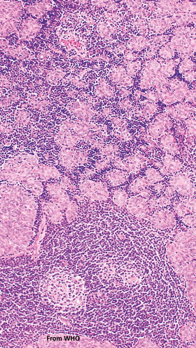 Charlie Herndon tweet media