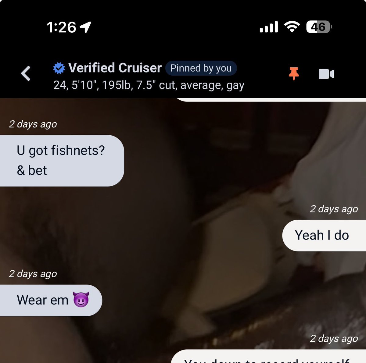 The Boy🧎🏻‍♂️🦴(GBM) tweet media