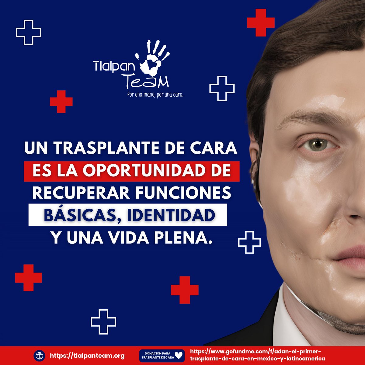 Trasplante mano/cara tweet media