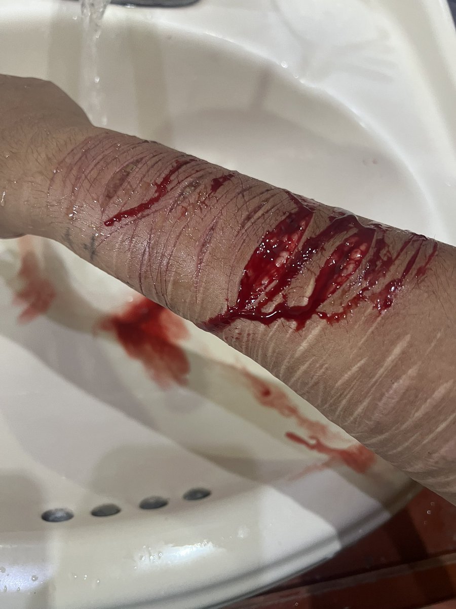 cigsl0ver's tweet photo. #sh #shtwt #gore #slittwt #988twt https://t.co/MX0FRXzYiv https://t.co/mj829BxTGy