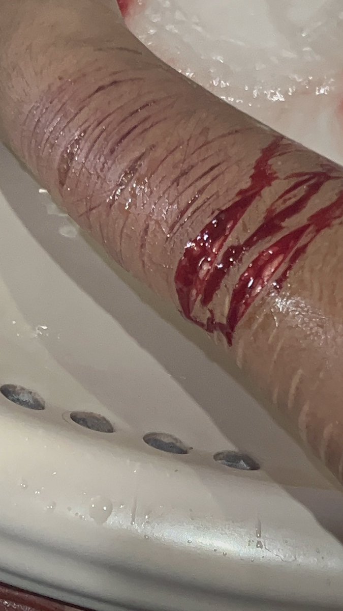 cigsl0ver's tweet photo. #sh #shtwt #gore #slittwt #988twt https://t.co/MX0FRXzYiv https://t.co/mj829BxTGy